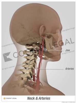 Neck and Arteries