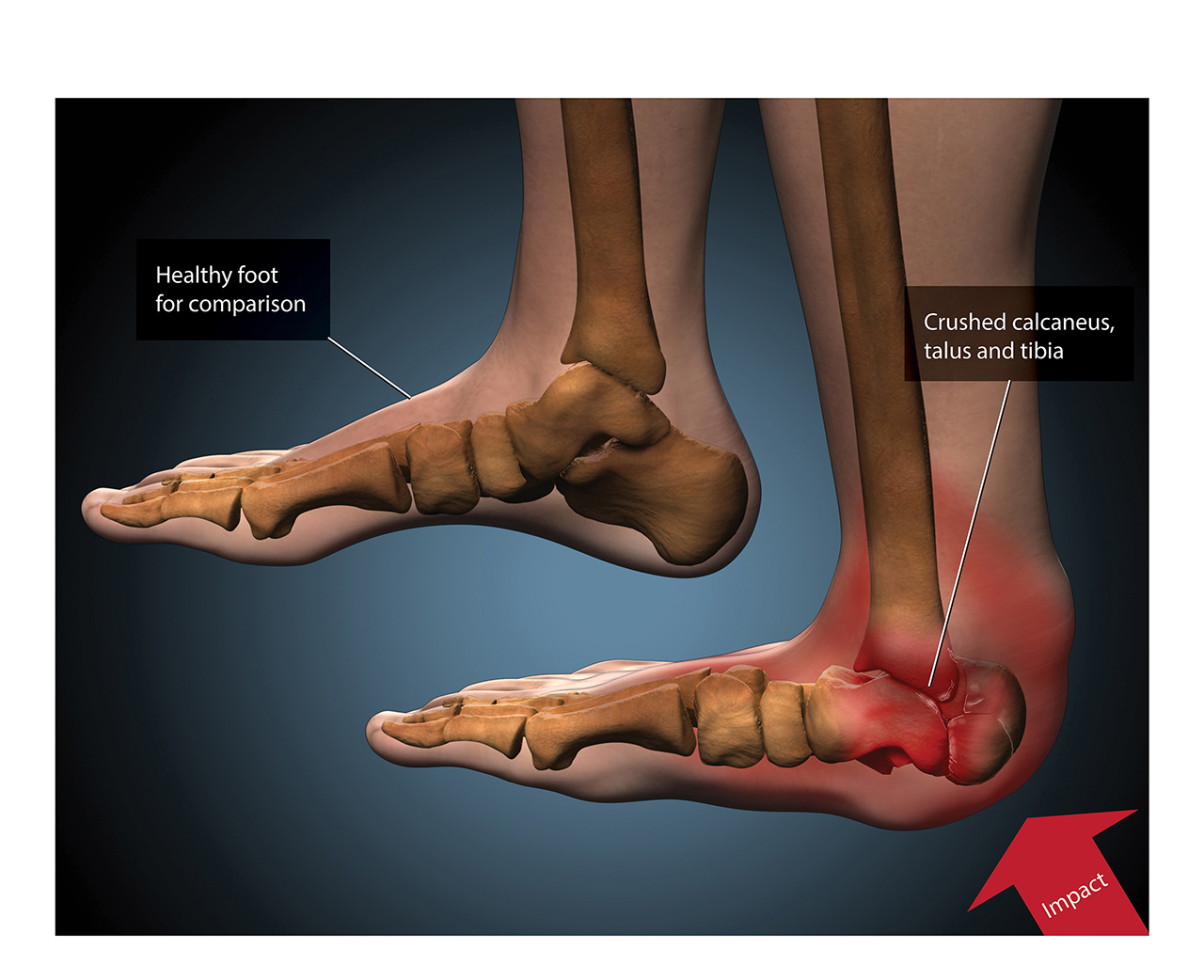 Medical – Foot.